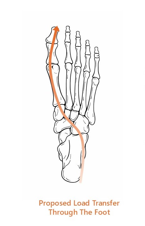 Illustration showing proposed progression of load through the medial foot and first ray, directing propulsion toward the hallux during late stance.