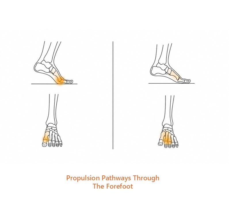 Illustration comparing two proposed propulsion pathways through the forefoot, showing load directed through the hallux on one side and through the central forefoot on the other.
