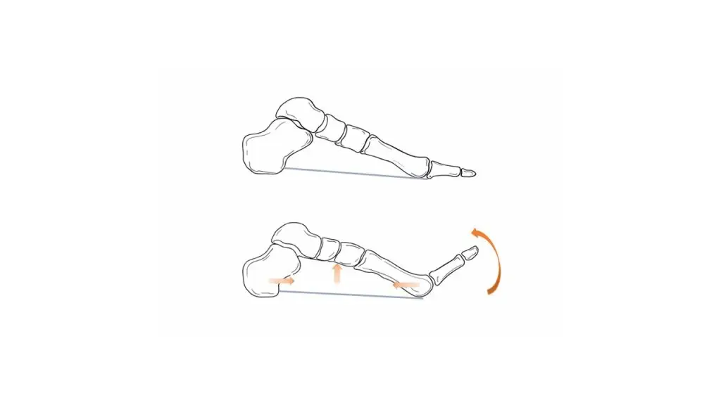 The Plantar Fascia: More Than Just Arch Support
