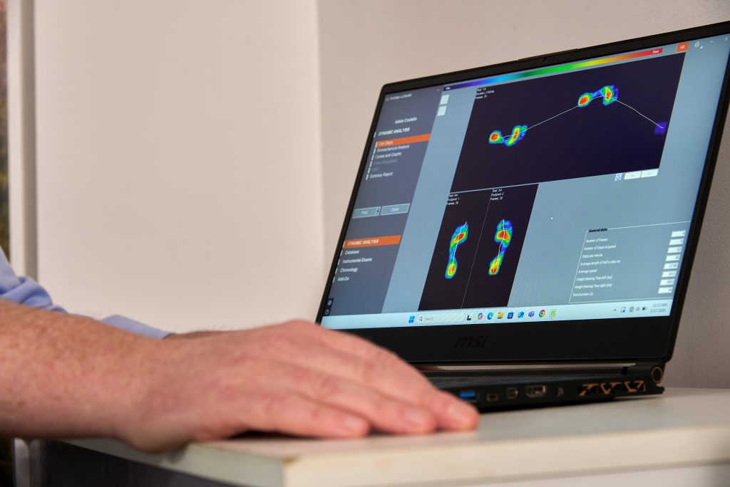 Plantar pressure mapping analysis during a specialist biomechanical foot and ankle assessment.